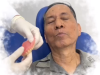 CẠO VÔI RĂNG CÔNG NGHỆ MỚI AIR POLISHING 