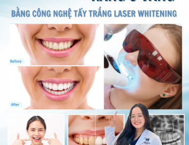 TẨY TRẮNG RĂNG