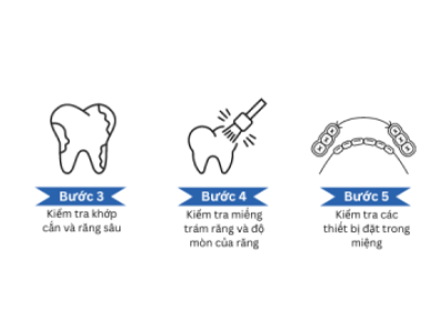Khám & Điều Trị Răng Miệng Tổng Quát – Nha Khoa TRUST TP.HCM