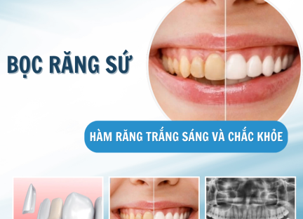 BỌC RĂNG SỨ