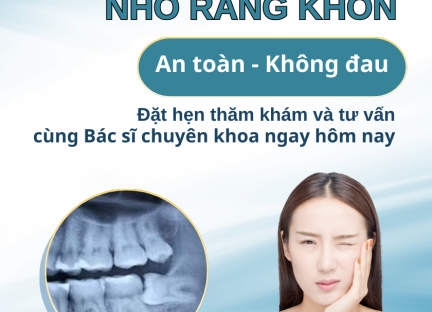 NHỔ RĂNG KHÔN