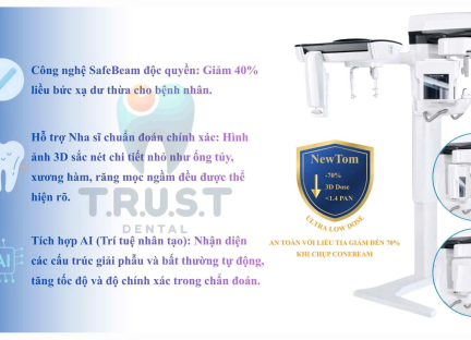 Máy chụp CT là gì? Ứng dụng, ưu điểm và lưu ý khi sử dụng