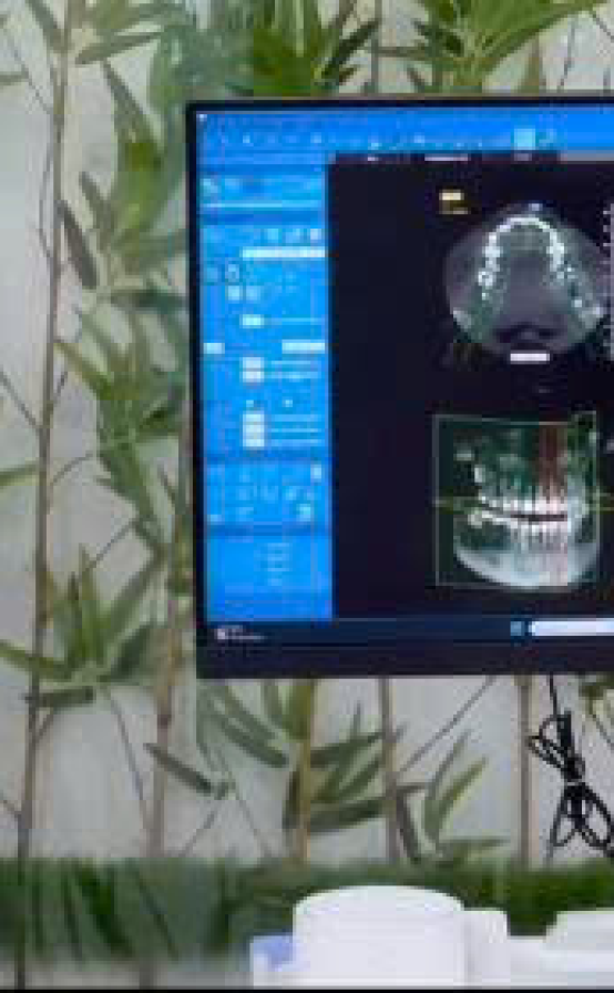 Video nhổ răng khôn 