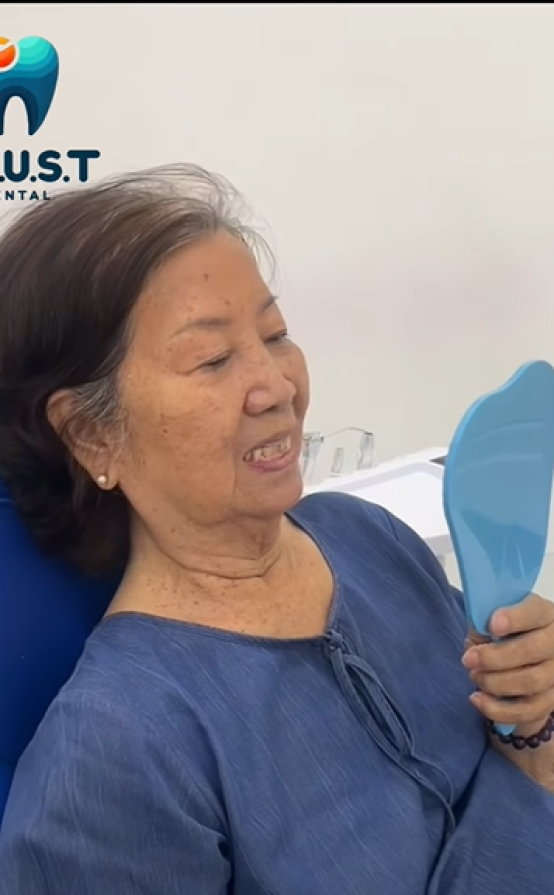 Hàm tháo lắp mới – Ăn ngon, nhai khỏe hơn, tăng tính thẩm mỹ hơn mỗi ngày