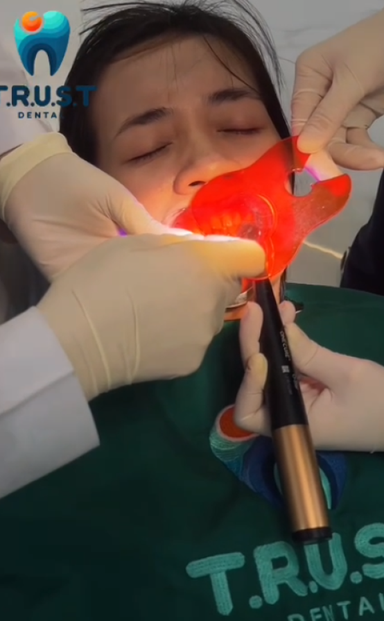 Tẩy Trắng Răng Tại Nha Khoa T.R.U.S.T