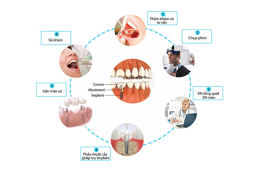 Quy trình khám răng miệng tổng quát tại Nha Khoa TRUST