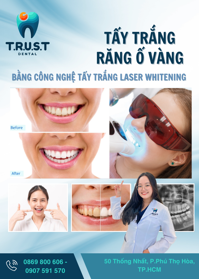 dịch vụ tẩy trắng răng