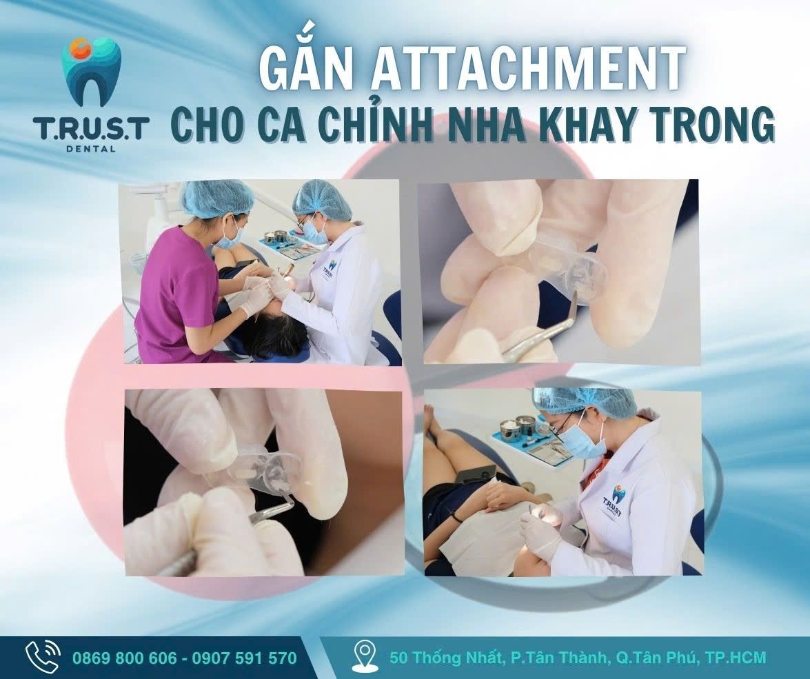 Liên hệ Nha Khoa TRUST TP.HCM