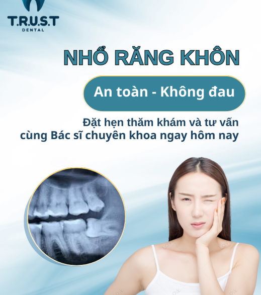 NHỔ RĂNG KHÔN